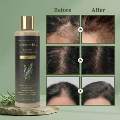 🔥LAST DAY 50% OFF - Hairmonthly® Organic Rosemary Hair Growth Shampoo