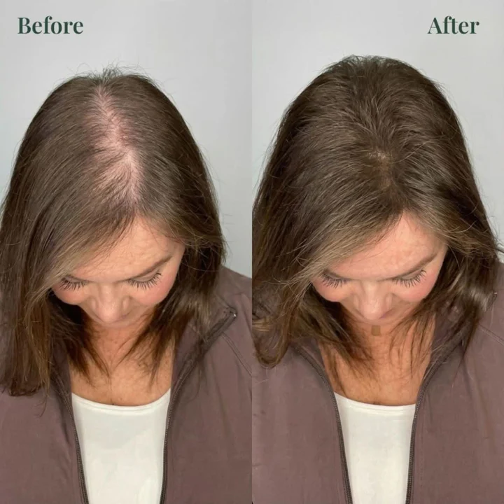 🔥LAST DAY 50% OFF - Hairmonthly® Organic Rosemary Hair Growth Shampoo