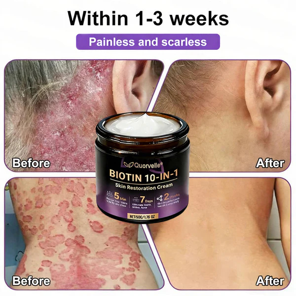 🔥LAST DAY SALE-80% OFF)Quorvelle® Biotin 10-in-1 Skin Restoration Cream