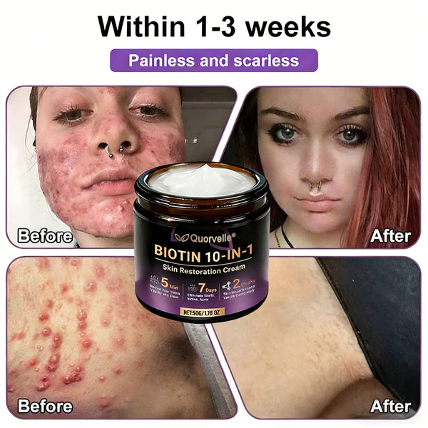 🔥LAST DAY SALE-80% OFF)Quorvelle® Biotin 10-in-1 Skin Restoration Cream