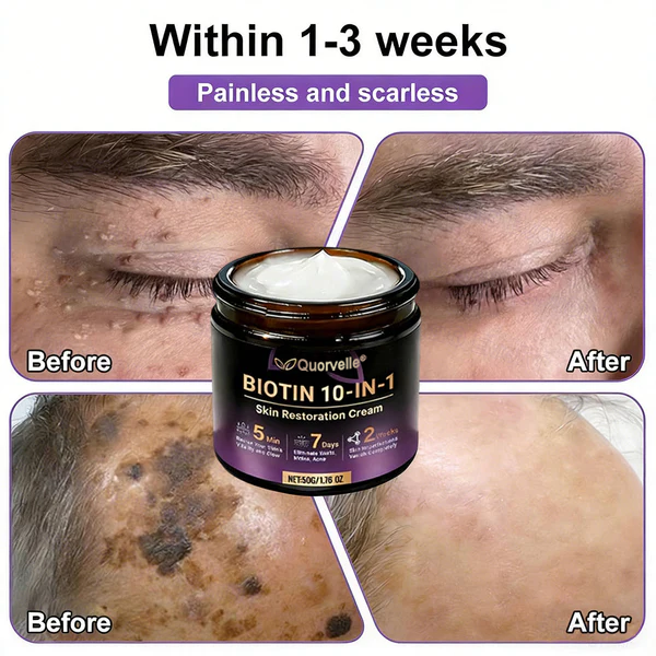 🔥LAST DAY SALE-80% OFF)Quorvelle® Biotin 10-in-1 Skin Restoration Cream