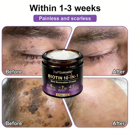 🔥LAST DAY SALE-80% OFF)Quorvelle® Biotin 10-in-1 Skin Restoration Cream