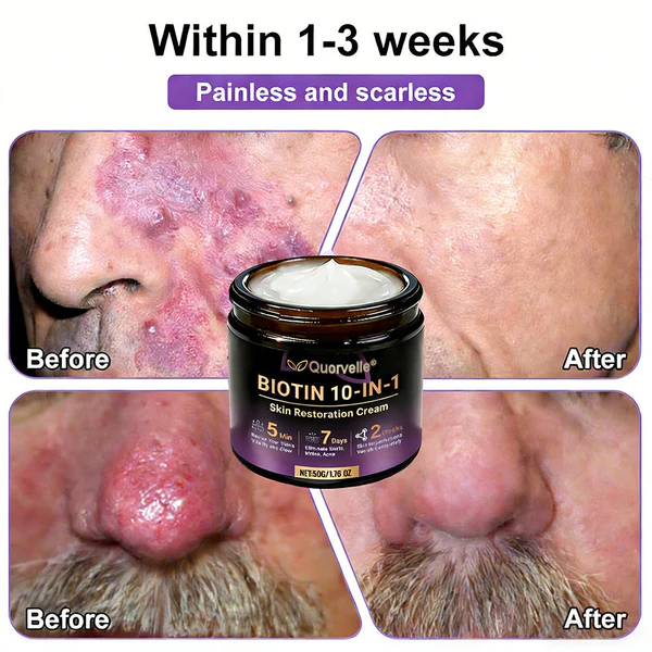 🔥LAST DAY SALE-80% OFF)Quorvelle® Biotin 10-in-1 Skin Restoration Cream