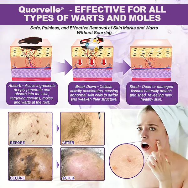 🔥LAST DAY SALE-80% OFF)Quorvelle® Biotin 10-in-1 Skin Restoration Cream
