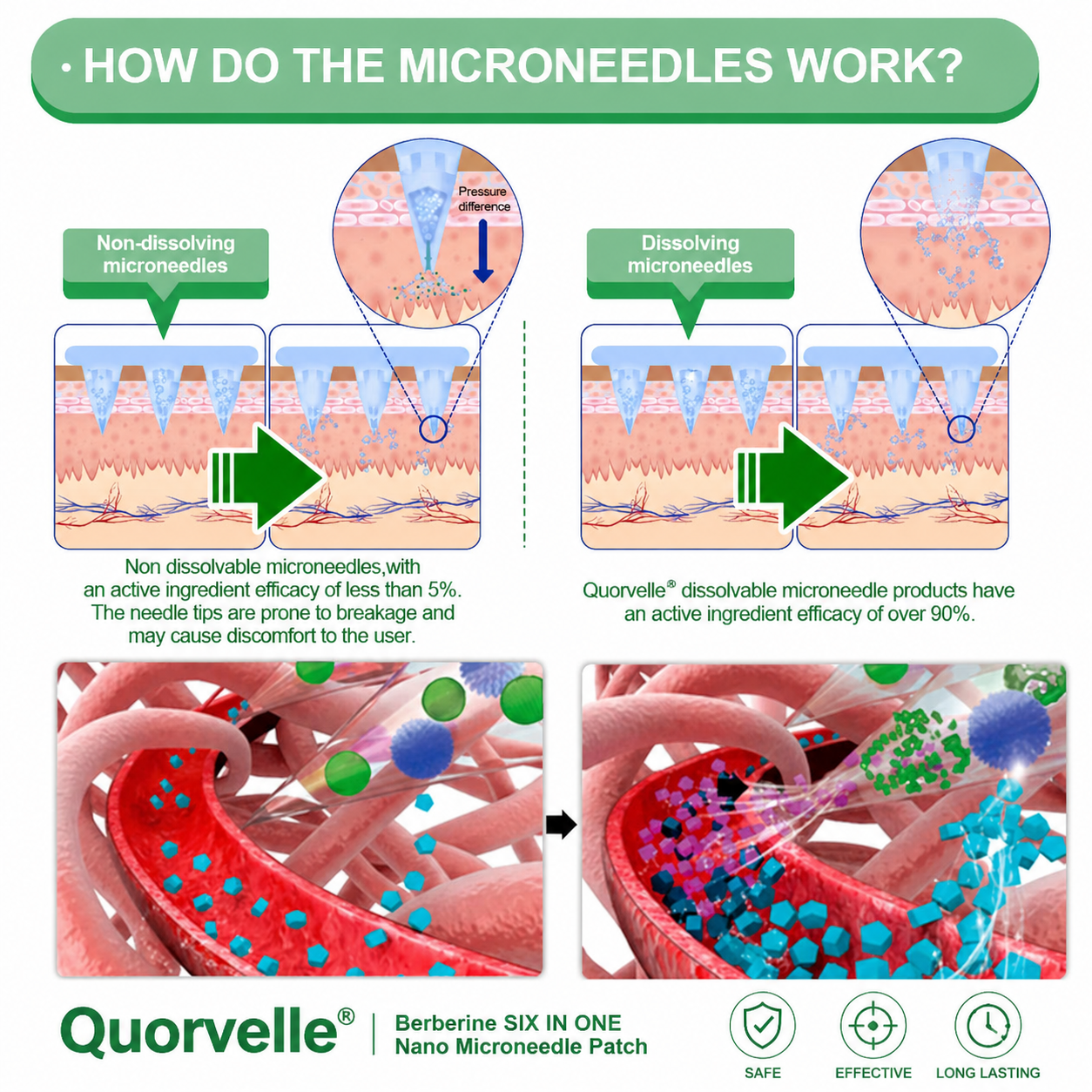 New 2026 Upgrade:  Quorvelle® 𝑩𝒆𝒓𝑏𝘦𝘳𝑖𝗇𝒆 𝟔-𝗶𝙣-𝟏 𝑁𝑎𝑛𝑜 𝘔𝘪𝘤𝘳𝘰𝘯𝘦𝘦𝘥𝘭𝘦 𝖯𝚊𝗍𝖼𝗁 with Science-Backed Formula