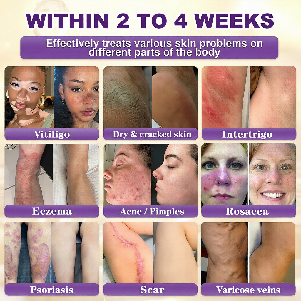 🔥LAST DAY SALE-80% OFF)Quorvelle® Biotin 10-in-1 Skin Restoration Cream